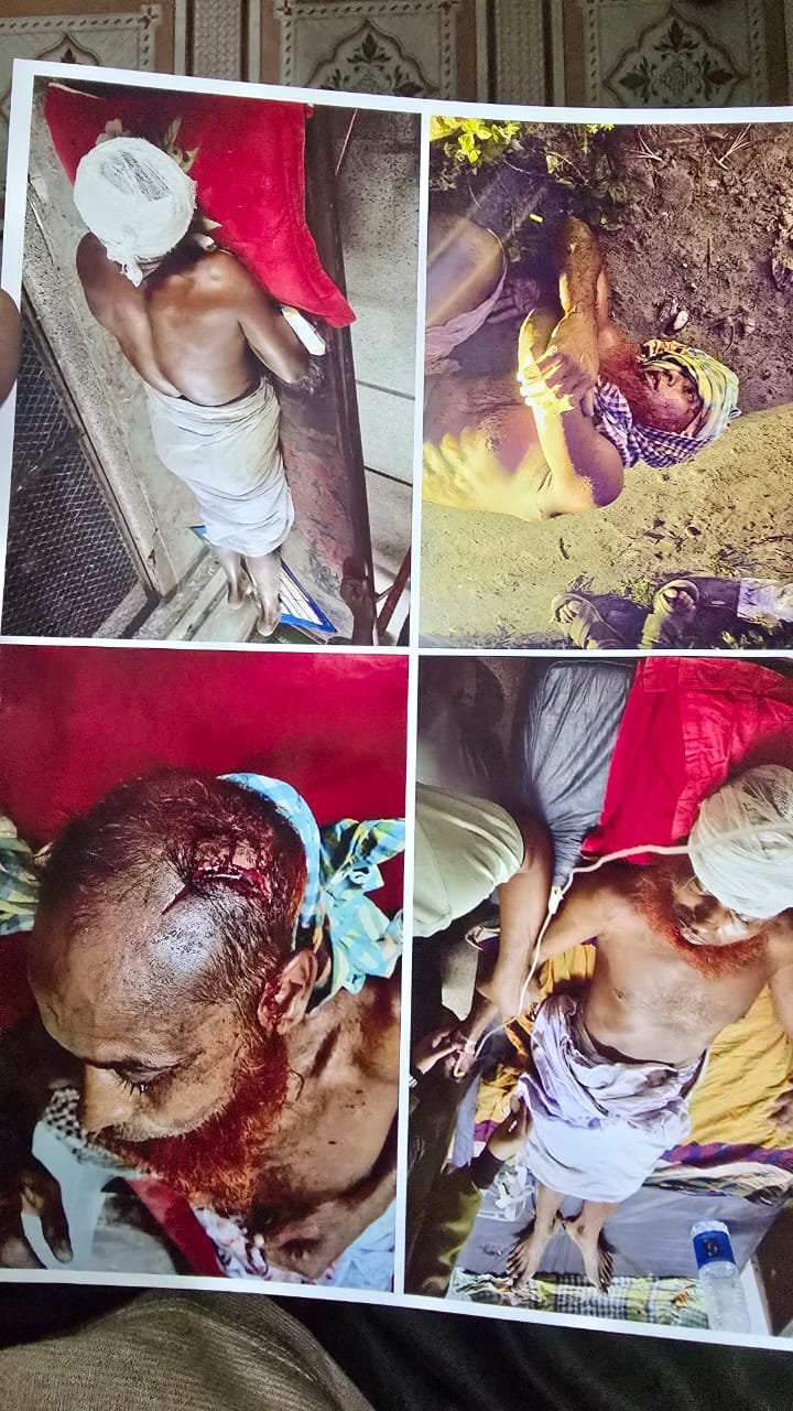 ত্রিশালে হাঁস মরার জেরে এয়ারটেল টাওয়ার কর্মীকে কুপিয়ে জখম, গ্রেপ্তার ২ 