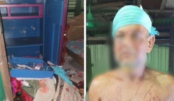 কোম্পানীগঞ্জে একই রাতে দুই বাড়িতে ডাকাতি, আহত ১